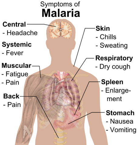 File:Symptoms of Malaria.png