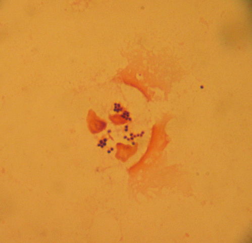 File:Staph sputum.JPG